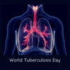 World Tuberculosis Day
