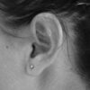 World Hearing Day 2021