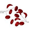Scikle Cells